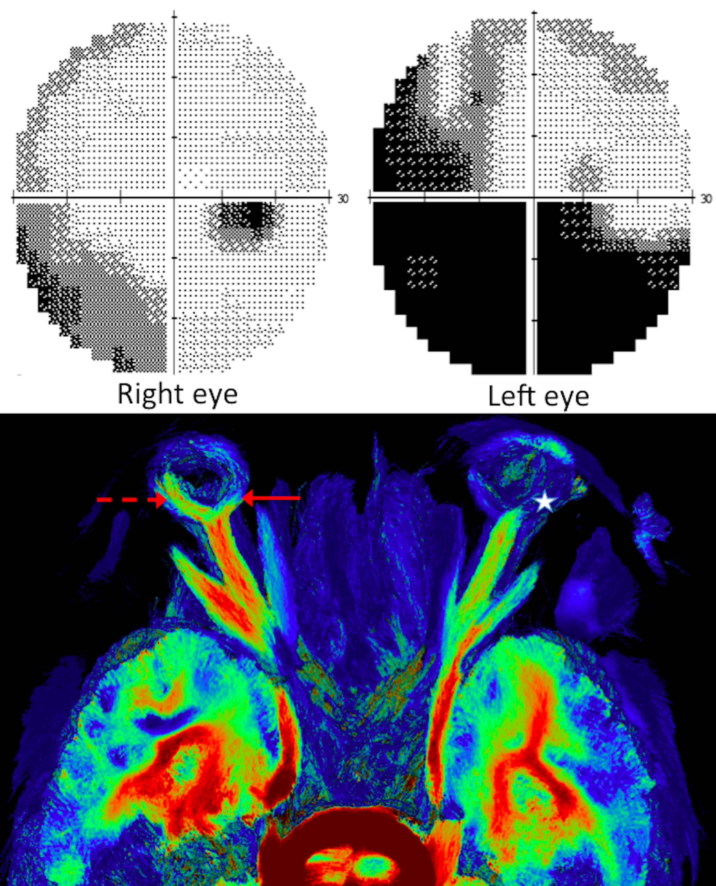 Fig5.tiff