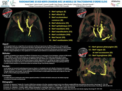 radioanatomie_3D_des_nerfs_craniens_tractographie.jpg